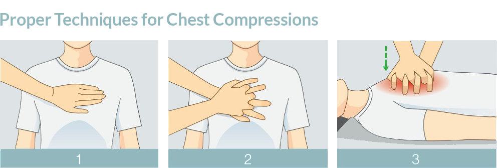 hands-only cpr graphic